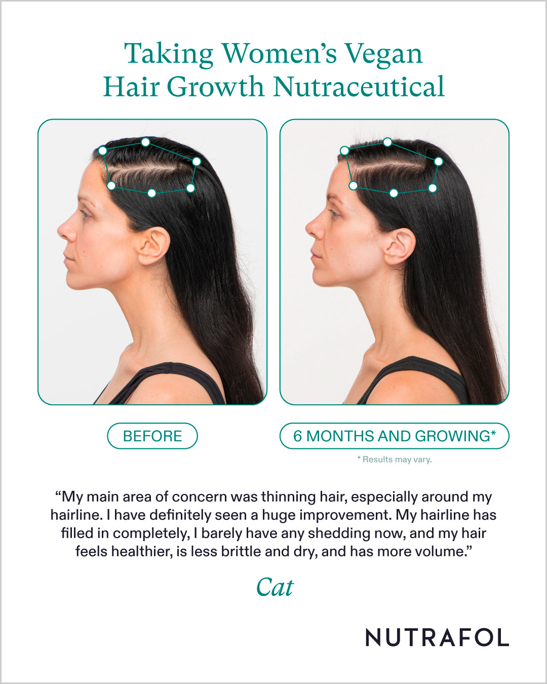 Nutrafol Women's Vegan Hair Growth Nutraceutical (1-Month Supply)