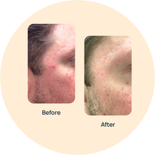 Rosacea Triple Cream image 0