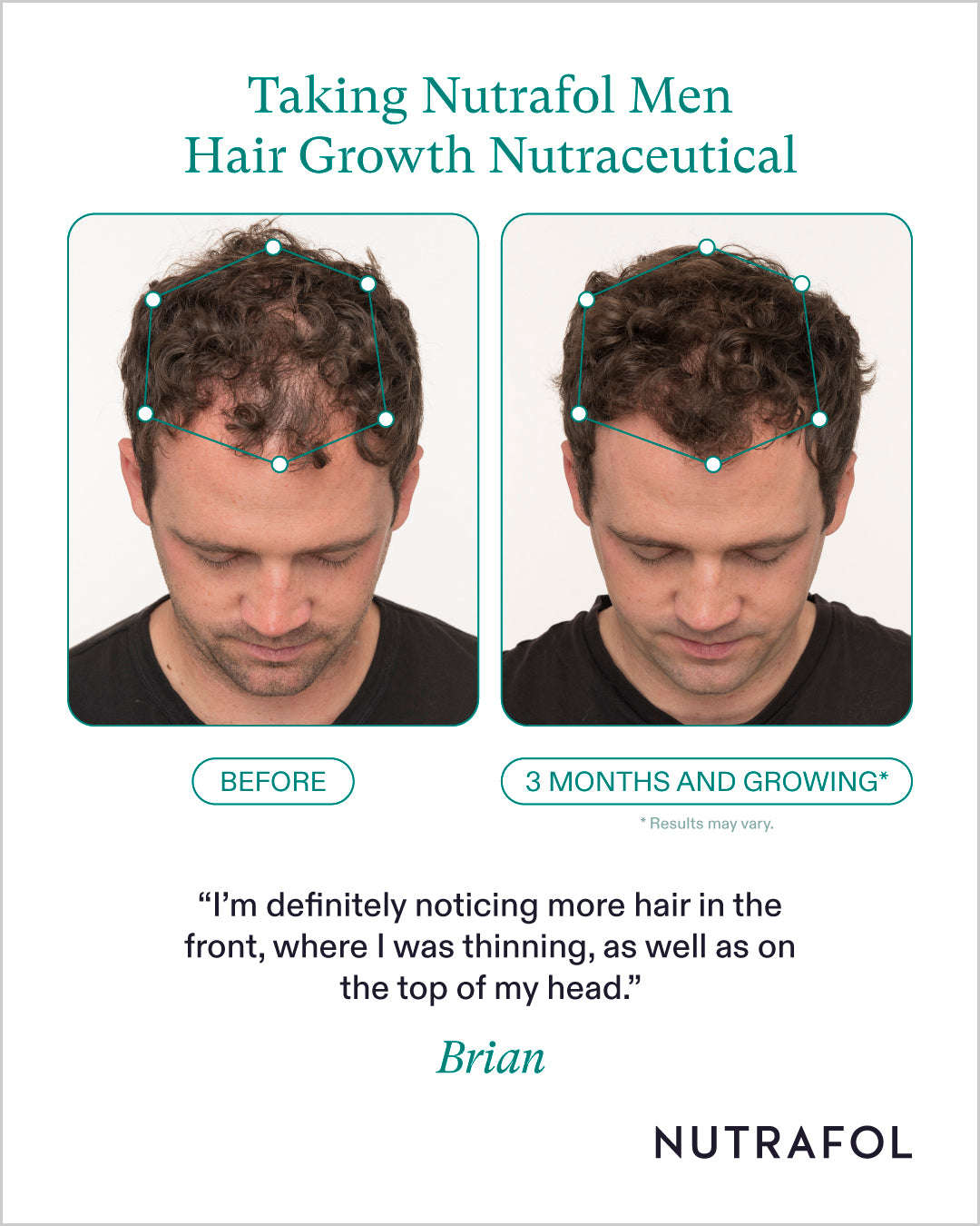 Nutrafol Mens Hair Growth Nutraceutical (1-Month Supply)