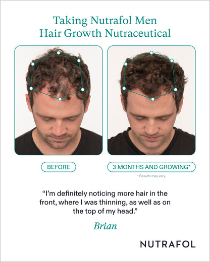 Nutrafol Mens Hair Growth Nutraceutical (1-Month Supply)