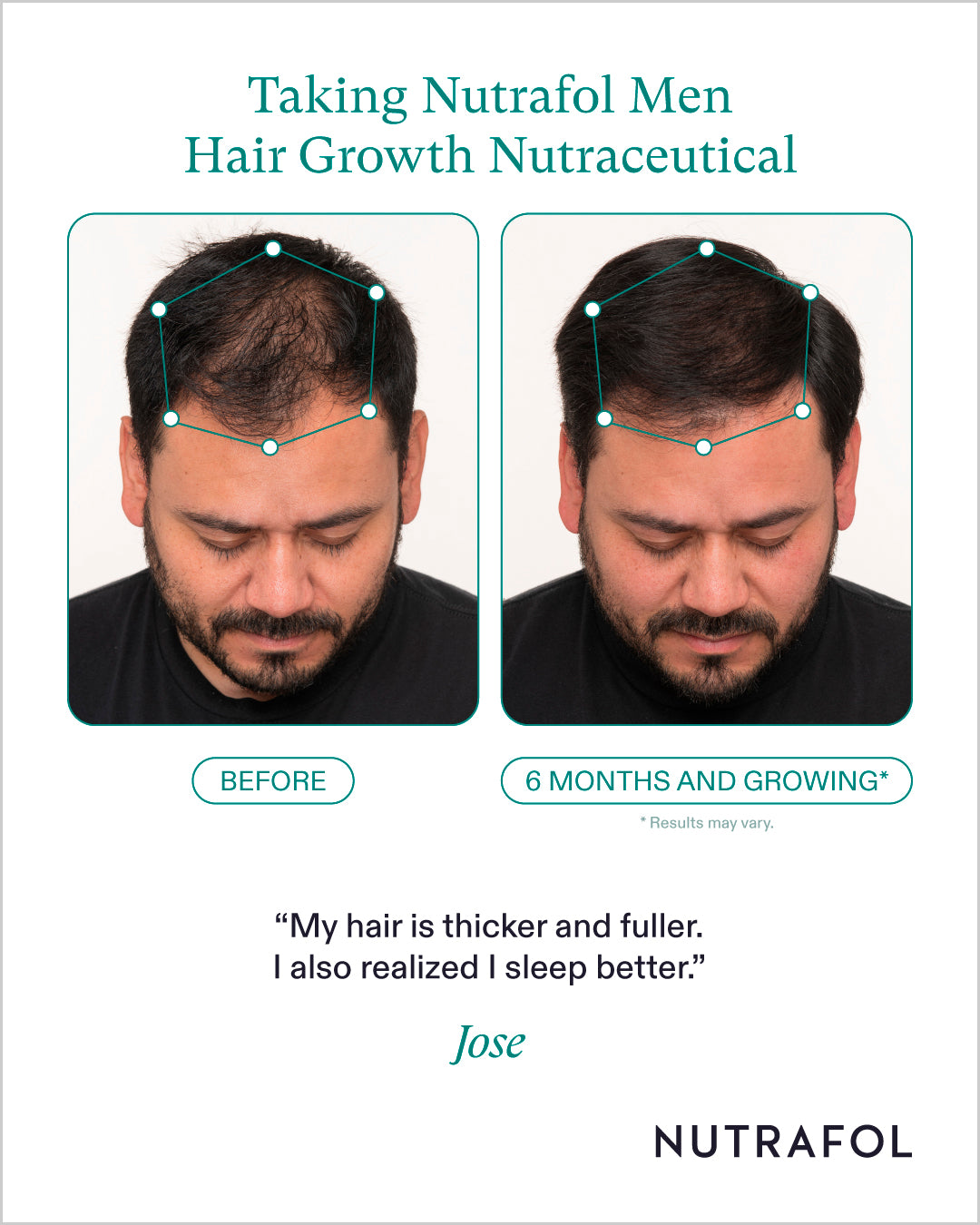 Nutrafol Mens Hair Growth Nutraceutical (1-Month Supply)
