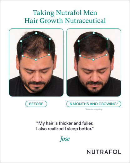 Nutrafol Mens Hair Growth Nutraceutical (1-Month Supply)