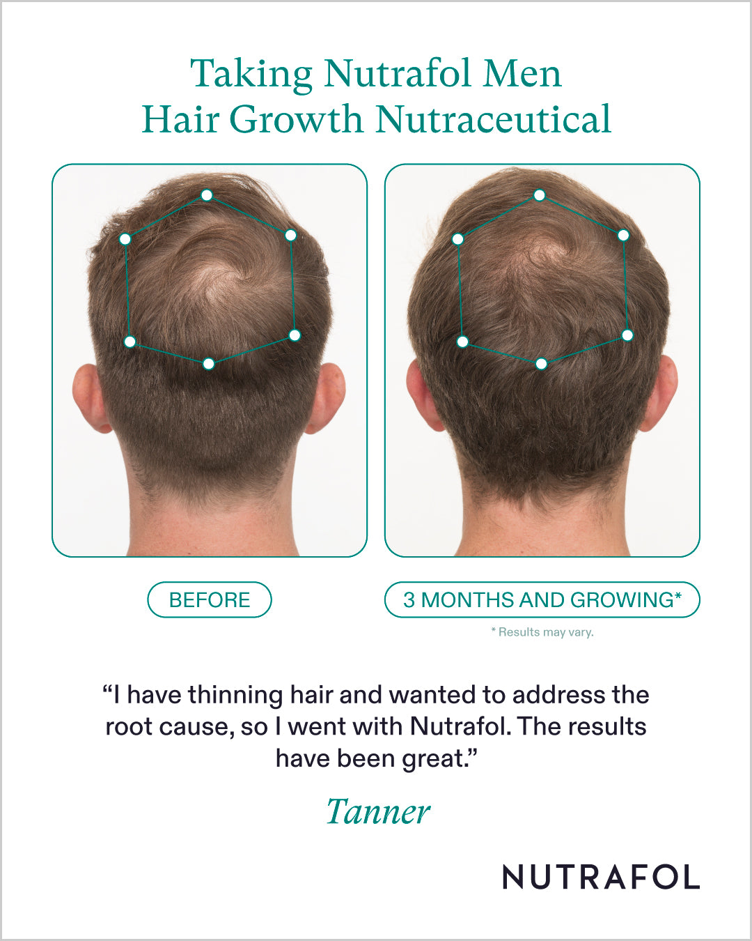 Nutrafol Mens Hair Growth Nutraceutical (1-Month Supply)