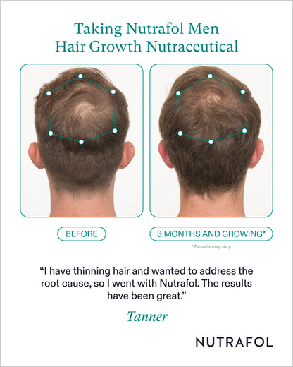 Nutrafol Mens Hair Growth Nutraceutical (1-Month Supply)