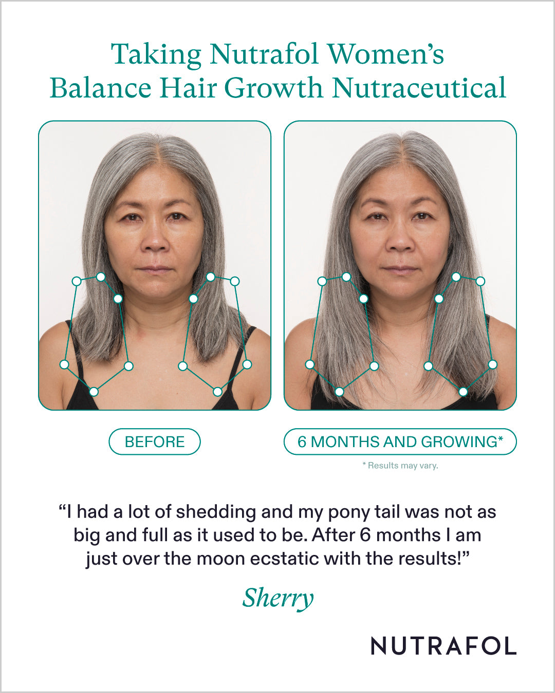 Nutrafol Women's Balance Hair Growth Nutraceutical (3-Month Supply)