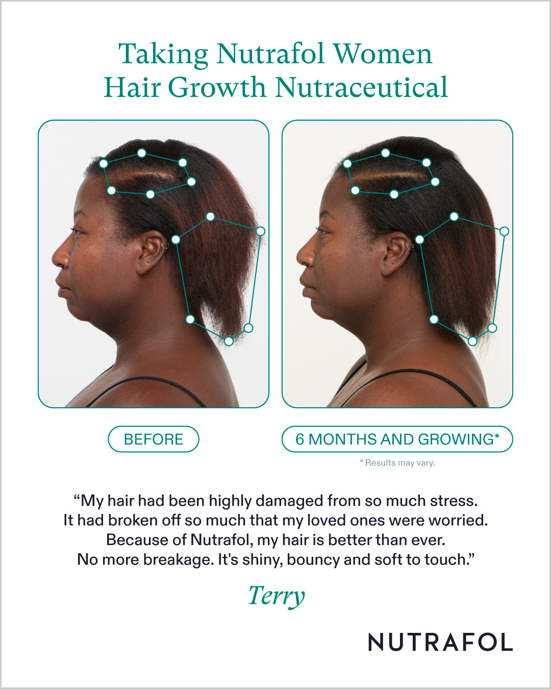 Nutrafol Women Hair Growth Nutraceutical (3-month supply)