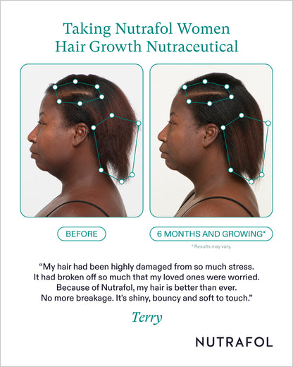 Nutrafol Women Hair Growth Nutraceutical (3-month supply)