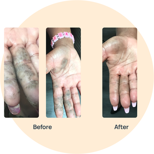 Inflammatory Conditions Medication image 0